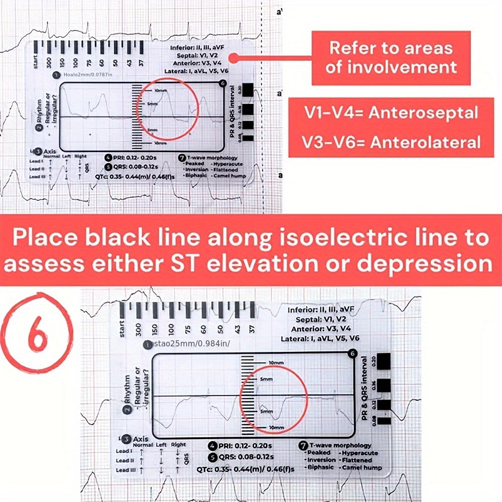 创意热销新款实用性便携 ECG 7 Step Ruler心电图7步尺