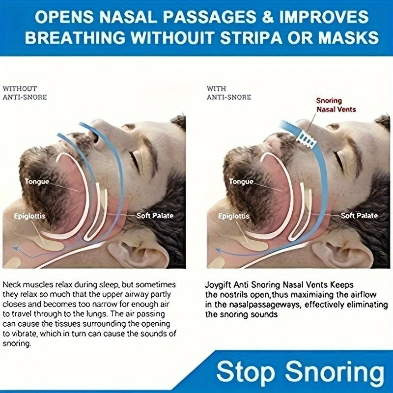 鼻呼吸器套裝與防打鼾裝置——助眠神器，緩解打鼾與鼻塞問題——行動式呼吸裝置，無需電池/電源，適用於阻塞性睡眠呼吸暫停及夜間呼吸改善，相容CPAP系統，適合各類睡眠環境
