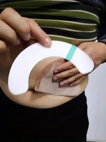 专业级水胶体防漏贴纸，适用于造口袋